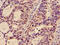 Glucosaminyl (N-Acetyl) Transferase 3, Mucin Type antibody, CSB-PA009329LA01HU, Cusabio, Immunohistochemistry paraffin image 