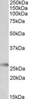 HLA-DXA antibody, EB10420, Everest Biotech, Western Blot image 