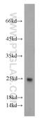 Troponin I1, Slow Skeletal Type antibody, 22253-1-AP, Proteintech Group, Western Blot image 