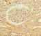 Patatin Like Phospholipase Domain Containing 1 antibody, CSB-PA843295LA01HU, Cusabio, Immunohistochemistry paraffin image 