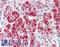 Clathrin Heavy Chain antibody, LS-B4174, Lifespan Biosciences, Immunohistochemistry frozen image 