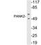 Pantothenate Kinase 2 antibody, A02776, Boster Biological Technology, Western Blot image 
