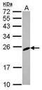 Regulator Of G Protein Signaling 2 antibody, PA5-29708, Invitrogen Antibodies, Western Blot image 