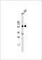 Testis Associated Actin Remodelling Kinase 2 antibody, 63-217, ProSci, Western Blot image 
