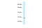 Transmembrane Protein 106B antibody, ARP47439_P050, Aviva Systems Biology, Western Blot image 