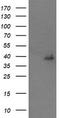 Dual specificity mitogen-activated protein kinase kinase 3 antibody, TA505701, Origene, Western Blot image 