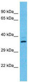 Olfactory Receptor Family 2 Subfamily T Member 12 antibody, TA337496, Origene, Western Blot image 