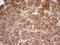 LIM Domain And Actin Binding 1 antibody, LS-C791688, Lifespan Biosciences, Immunohistochemistry paraffin image 