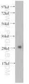 Ribosomal Protein S6 antibody, 14823-1-AP, Proteintech Group, Western Blot image 