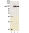 Aryl Hydrocarbon Receptor antibody, LS-C343820, Lifespan Biosciences, Western Blot image 