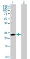 Cell Division Cycle 20B antibody, H00166979-B01P, Novus Biologicals, Western Blot image 