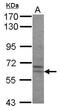 Preferentially Expressed Antigen In Melanoma antibody, GTX106248, GeneTex, Western Blot image 