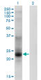 Tetraspanin 8 antibody, LS-C198348, Lifespan Biosciences, Western Blot image 