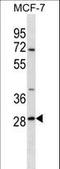 SRP Receptor Subunit Beta antibody, LS-C161506, Lifespan Biosciences, Western Blot image 