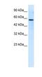 RUN And FYVE Domain Containing 3 antibody, NBP1-80039, Novus Biologicals, Western Blot image 