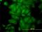 Tubulin Alpha 4a antibody, H00007277-M01, Novus Biologicals, Immunocytochemistry image 