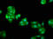 Arginyltransferase 1 antibody, LS-C673420, Lifespan Biosciences, Immunofluorescence image 
