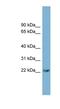 P53 Apoptosis Effector Related To PMP22 antibody, NBP1-62434, Novus Biologicals, Western Blot image 