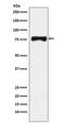 Tyrosinase Related Protein 1 antibody, M01959-1, Boster Biological Technology, Western Blot image 