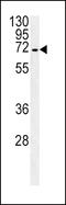 Organic cation transporter 1 antibody, LS-C161155, Lifespan Biosciences, Western Blot image 