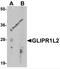 GLIPR1 Like 2 antibody, 7639, ProSci, Western Blot image 