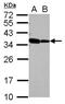 RNA Binding Motif Protein 11 antibody, NBP2-20101, Novus Biologicals, Western Blot image 