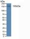 Insulin Receptor antibody, LS-C294670, Lifespan Biosciences, Western Blot image 