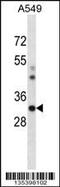 Casein Kinase 1 Alpha 1 antibody, MBS9209933, MyBioSource, Western Blot image 