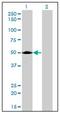 Acid Phosphatase 2, Lysosomal antibody, AM31142PU-N, Origene, Western Blot image 