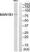 Mannosidase Alpha Class 1B Member 1 antibody, TA312707, Origene, Western Blot image 