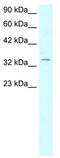 Homeobox D12 antibody, TA330644, Origene, Western Blot image 