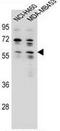 Ankyrin Repeat Domain 34C antibody, AP50186PU-N, Origene, Western Blot image 