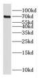 Transcription Factor 3 antibody, FNab02599, FineTest, Western Blot image 
