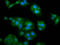 Zinc finger RNA-binding protein antibody, LS-C682340, Lifespan Biosciences, Immunofluorescence image 