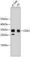 Cyclin Dependent Kinase 2 antibody, 13-811, ProSci, Western Blot image 