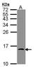 Islet Amyloid Polypeptide antibody, PA5-29713, Invitrogen Antibodies, Western Blot image 