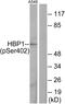 HMG-Box Transcription Factor 1 antibody, PA5-38576, Invitrogen Antibodies, Western Blot image 