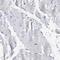 Lymphocyte Cytosolic Protein 2 antibody, NBP1-87032, Novus Biologicals, Immunohistochemistry paraffin image 