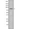 ArfGAP With Coiled-Coil, Ankyrin Repeat And PH Domains 2 antibody, abx147906, Abbexa, Western Blot image 