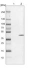 SVOP Like antibody, NBP1-93466, Novus Biologicals, Western Blot image 