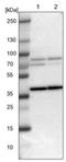 Polypeptide N-Acetylgalactosaminyltransferase 17 antibody, NBP1-81843, Novus Biologicals, Western Blot image 