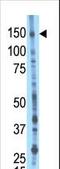 BMP2 Inducible Kinase antibody, LS-C97874, Lifespan Biosciences, Western Blot image 