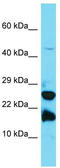 Gamma-Glutamylamine Cyclotransferase antibody, TA331686, Origene, Western Blot image 