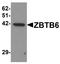 Zinc Finger And BTB Domain Containing 6 antibody, NBP1-76519, Novus Biologicals, Western Blot image 