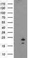 Fibroblast Growth Factor 21 antibody, TA502992S, Origene, Western Blot image 