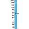 Keratin 4 antibody, M07410-2, Boster Biological Technology, Western Blot image 