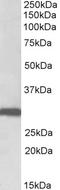 STOM antibody, LS-B10402, Lifespan Biosciences, Western Blot image 