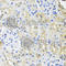 Heterogeneous Nuclear Ribonucleoprotein L antibody, A8430, ABclonal Technology, Immunohistochemistry paraffin image 