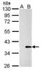 Galectin 4 antibody, PA5-32251, Invitrogen Antibodies, Western Blot image 