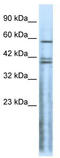 Cholinergic Receptor Nicotinic Delta Subunit antibody, TA330429, Origene, Western Blot image 